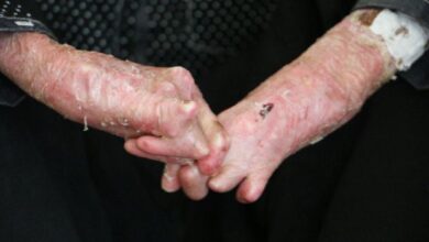 ضرورت اطلاع‌رسانی درباره ازدواج‌های فامیلی و بیماری‌های ژنتیکی