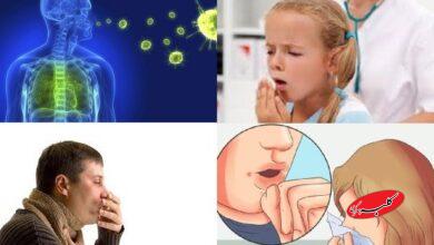 موارد ابتلا به سل در جهان به بالاترین حد خود رسیده است