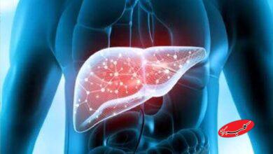 کدام مواد غذایی قاتل کبد چرب است؟