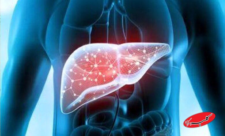 کدام مواد غذایی قاتل کبد چرب است؟