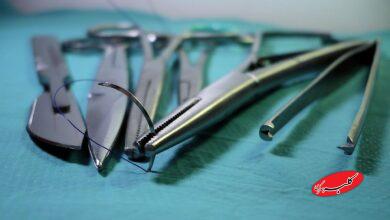 خطرناکترین عمل زیبایی دنیا؛ نابینا میشوید!