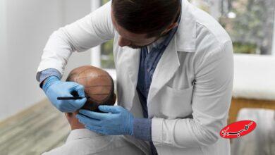 معرفی بهترین کلینیک کاشت مو برای افراد معروف