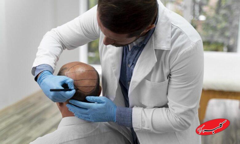 معرفی بهترین کلینیک کاشت مو برای افراد معروف