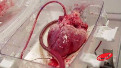 انتقال قلب برای پیوند به نوجوان ۱۵ ساله با اورژانس هوایی