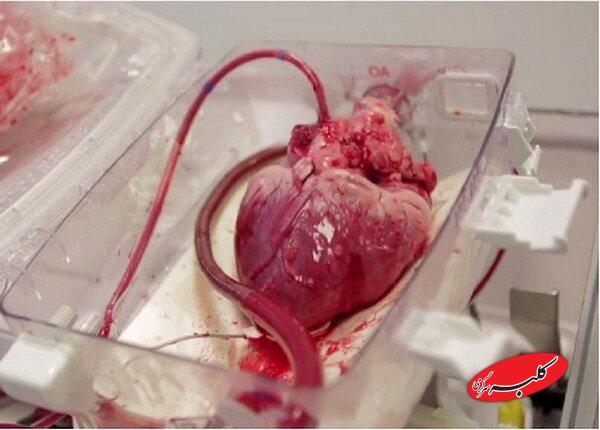 انتقال قلب برای پیوند به نوجوان ۱۵ ساله با اورژانس هوایی
