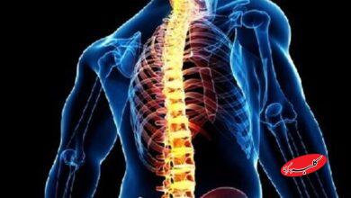 افزایش درد و مشکلات ستون فقرات در نسل جوان