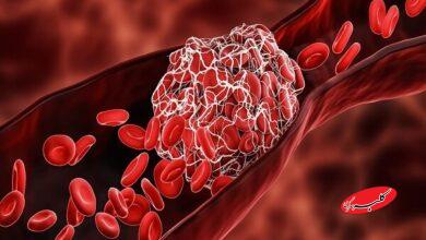 چربی خون بالا؛ دشمن خاموش رگ‌ها