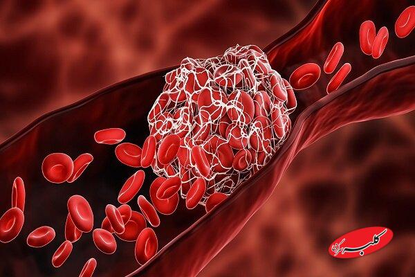 چربی خون بالا؛ دشمن خاموش رگ‌ها