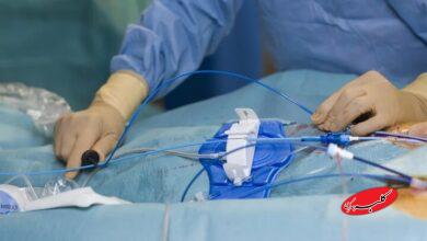 روش طلایی تشخیص تنگی عروق قلب در بیماران