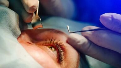 جراحی چشم - چشم پزشکی