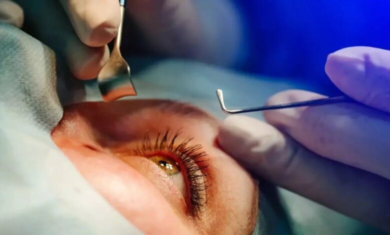 جراحی چشم - چشم پزشکی