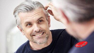 سفید شدن مو