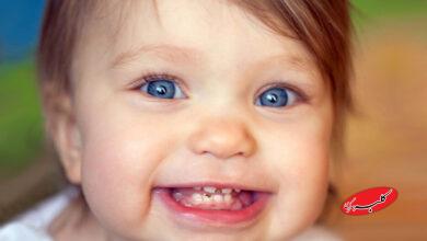 پوسیدگی دندان در کودکان