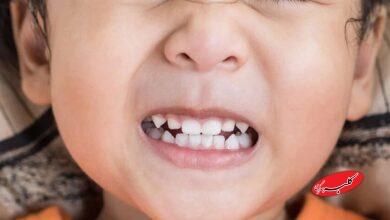 دندان قروچه