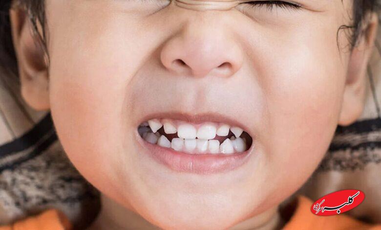 دندان قروچه