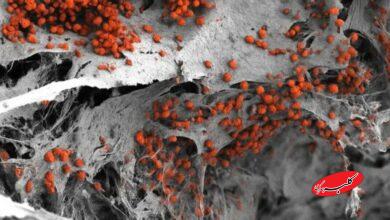 مغز استخوان