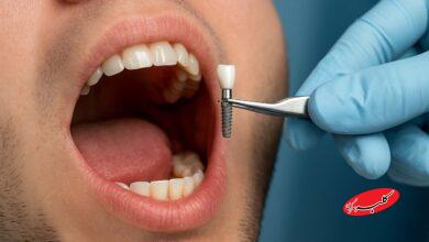 دندانپزشکی