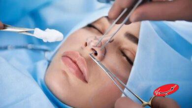 افزایش شکایات از جراحیهای زیبایی