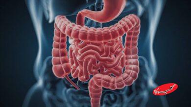 شیوع مشکلات گوارشی در دوران یائسگی