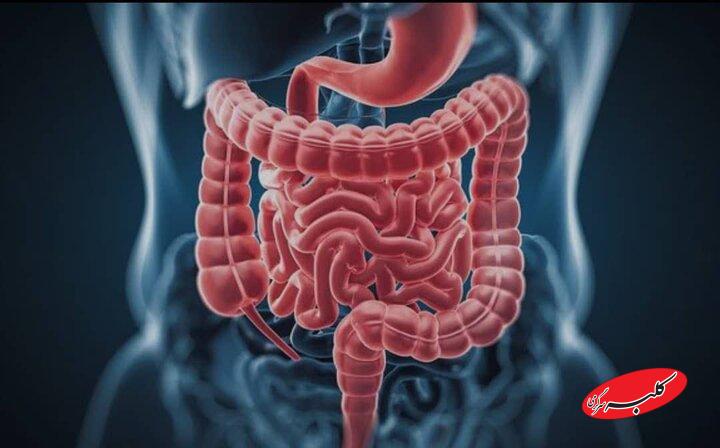 شیوع مشکلات گوارشی در دوران یائسگی