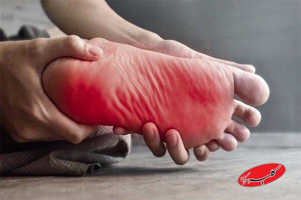 داغی کف پا در شب؛ نشانه‌ای از اختلال عصبی یا متابولیک