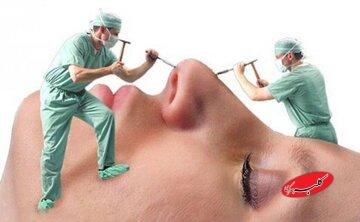 چرا شیادها در بازار جراحی زیبایی کاسبی شان پررونق است؟