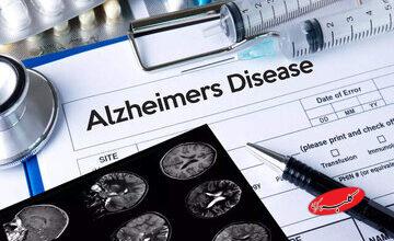 علائم اولیه شروع آلزایمر