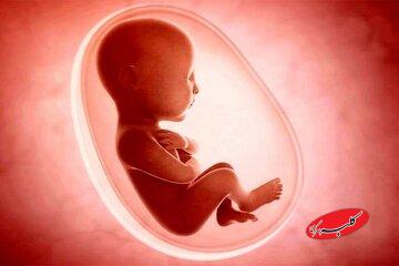 ۸۰ درصد شاکیان سقط جنین مردها هستند/ مواردی که قاضی اجازه سقط جنین قانونی نمی‌دهد