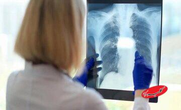 یک علت مهم و کمتر گفته شده درباره خستگی مزمن