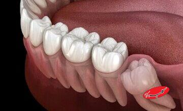 با خواندن این دلیل حتما سراغ مسواک و نخ دندان می‌روید