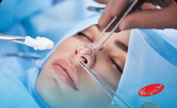 جراحی بینی بدون بیهوشی توسط دستیار دیپلمه پزشک