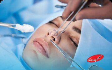 جراحی بینی بدون بیهوشی توسط دستیار دیپلمه پزشک