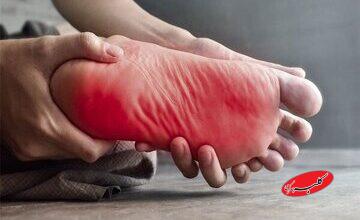 داغی کف پا نشانه چیست؟/ این علائم را جدی بگیرید