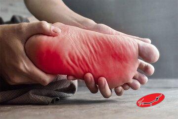 داغی کف پا نشانه چیست؟/ این علائم را جدی بگیرید