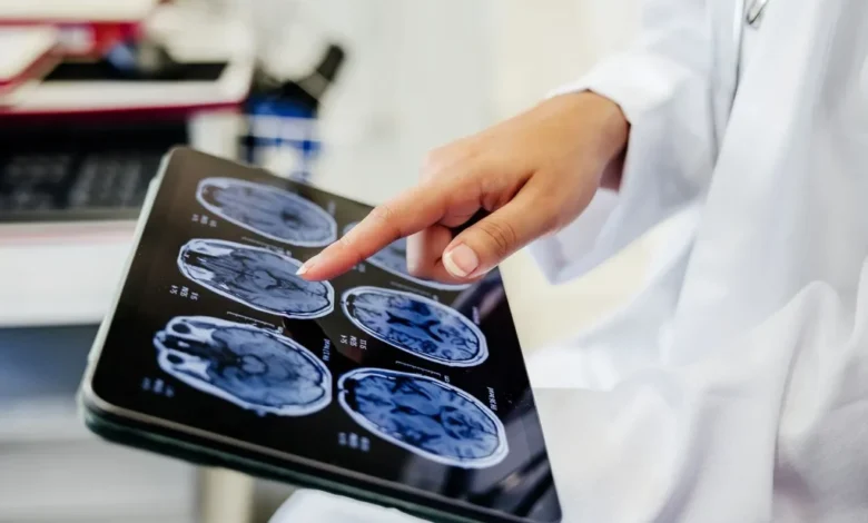 تغییر ساختار مغز انسان