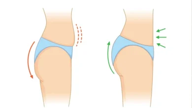 عمل لیفت باسن برزیلی