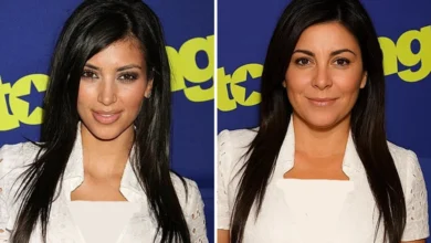 کیم کارداشیان بدون عمل