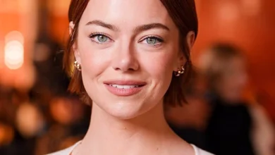 اما استون پس از جراحی زیبایی