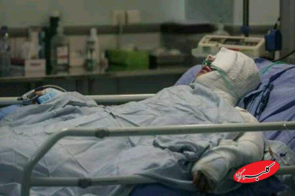 ۸۵ درصد سوختگیها با روشهای ساده قابل پیشگیری است