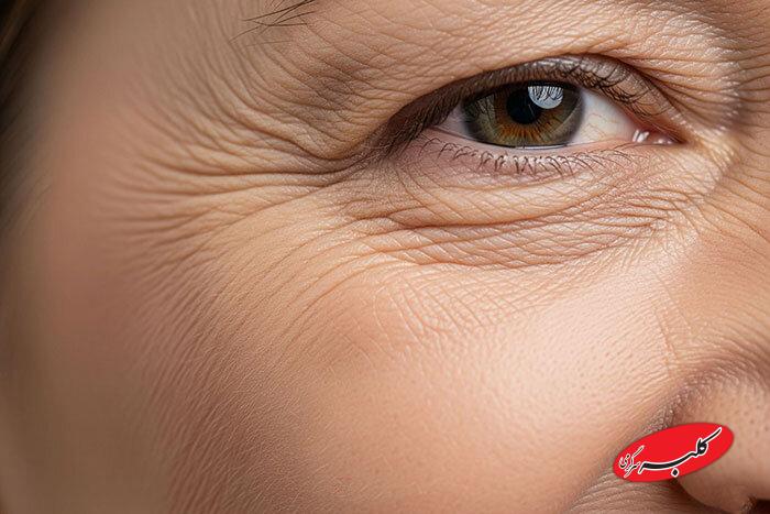 این اشتباه غذایی پوست را پیر میکند