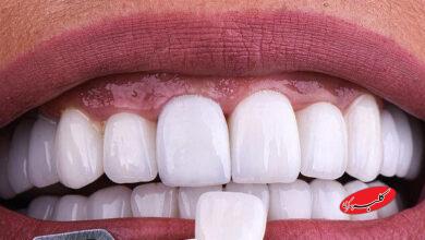 نمایندهای که کلینیک دندانپزشکی متخلف را تبلیغ کرد،که بود؟