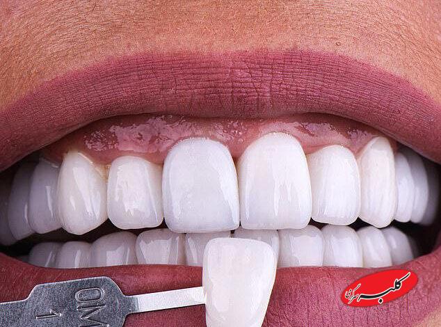 نمایندهای که کلینیک دندانپزشکی متخلف را تبلیغ کرد،که بود؟