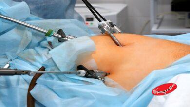 این روش درمان چاقی سلامتی شما را تهدید میکند