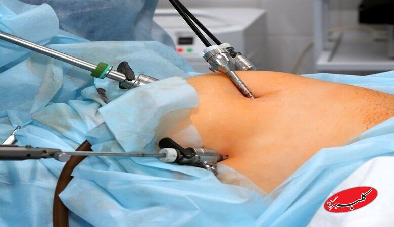 این روش درمان چاقی سلامتی شما را تهدید میکند