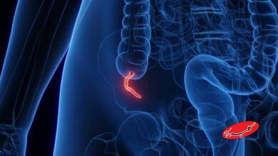 شیوع یک بیماری نادر میان جوانان پزشکان را نگران کرده