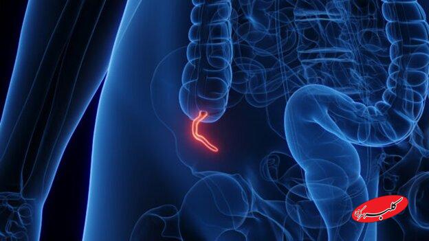 شیوع یک بیماری نادر میان جوانان پزشکان را نگران کرده