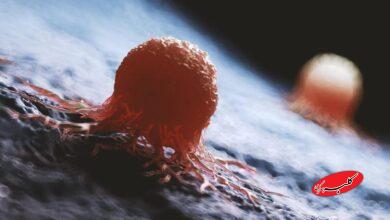 غذاهای ناسالمی که خطر ابتلا به این بیماری هولناک را افزایش میدهند