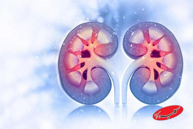 سلامت مغز با عملکرد کلیهها مرتبط است