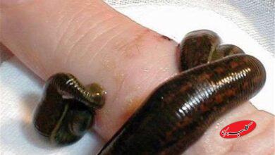 زالودرماني