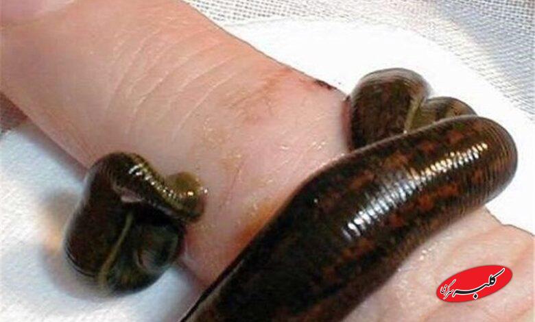 زالودرماني